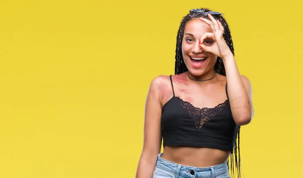 Jonge Gevlochten Haar Afrikaanse Amerikaan Met Pigmentatie Smet Geboorte Mark — Stockfoto