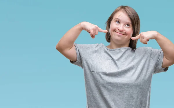 Jonge Volwassen Vrouw Met Het Syndroom Van Geïsoleerde Achtergrond Glimlachend — Stockfoto