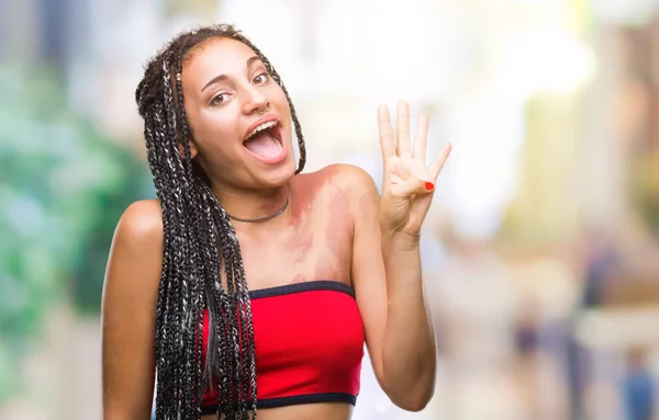 Cabello Trenzado Joven Afroamericano Con Mancha Pigmentación Marca Nacimiento Sobre —  Fotos de Stock