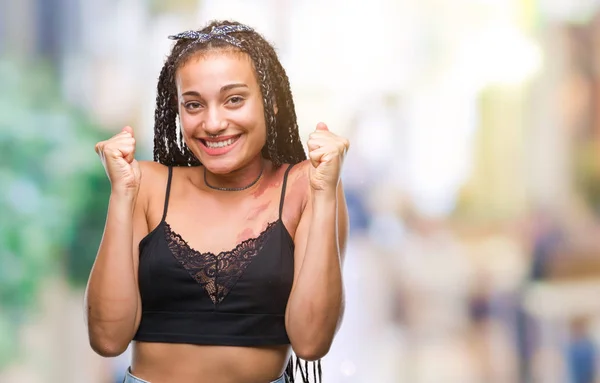 Cabello Trenzado Joven Afroamericano Con Mancha Pigmentación Marca Nacimiento Sobre — Foto de Stock