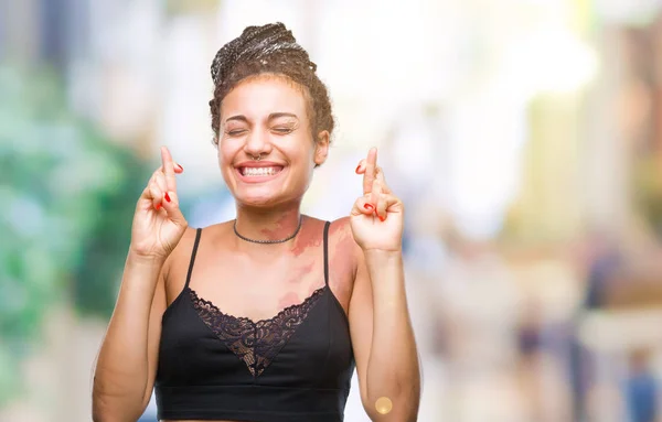 Cabello Trenzado Joven Afroamericano Con Mancha Pigmentación Marca Nacimiento Sobre —  Fotos de Stock