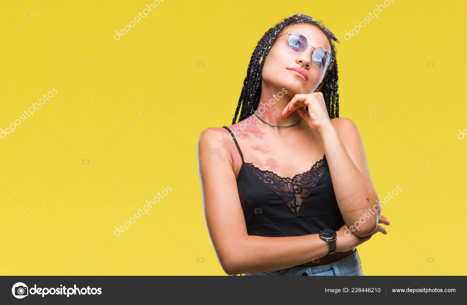 Young Braided Hair African American Birth Mark Wearing Sunglasses