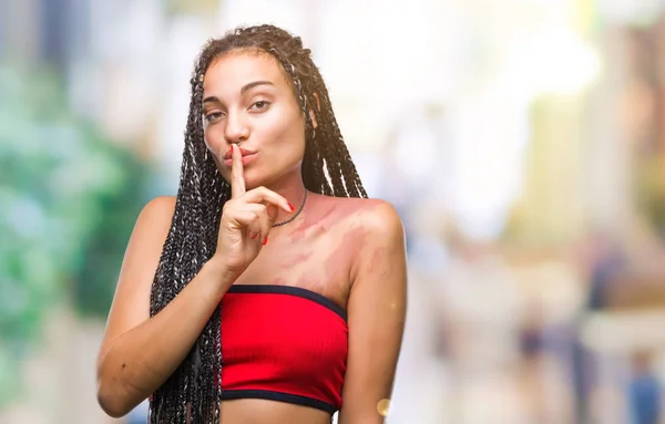 Cabello Trenzado Joven Afroamericano Con Manchas Pigmentación Marca Nacimiento Sobre —  Fotos de Stock