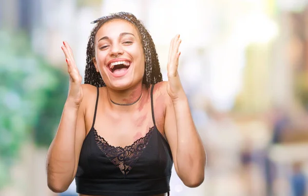 Joven Cabello Trenzado Afroamericano Con Manchas Pigmentación Marca Nacimiento Sobre —  Fotos de Stock