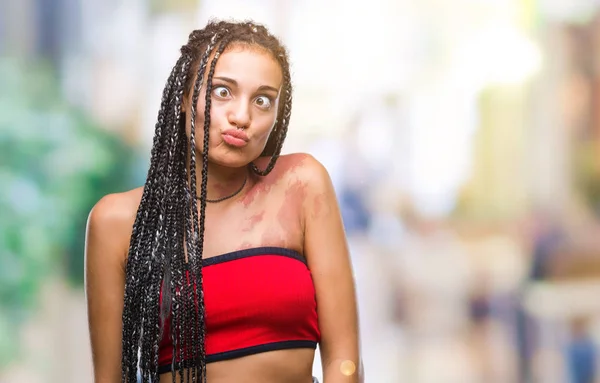 Cabello Trenzado Joven Afroamericano Con Manchas Pigmentación Marca Nacimiento Sobre — Foto de Stock