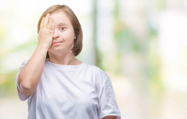 Giovane Donna Adulta Con Sindrome Sfondo Isolato Che Copre Occhio — Foto Stock
