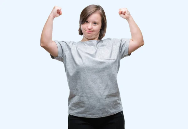 Giovane Donna Adulta Con Sindrome Sfondo Isolato Mostrando Muscoli Delle — Foto Stock