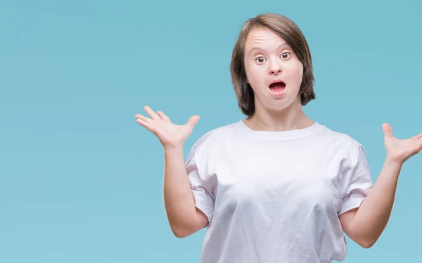 Junge Erwachsene Frau Mit Syndrom Über Isolierten Hintergrund Feiert Verrückt — Stockfoto