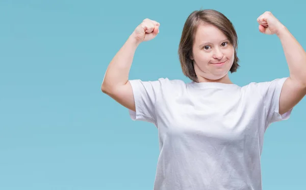 Mulher Adulta Jovem Com Síndrome Sobre Fundo Isolado Mostrando Músculos — Fotografia de Stock