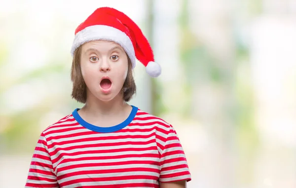 Mujer Adulta Joven Con Síndrome Con Sombrero Navidad Sorprendido Con —  Fotos de Stock