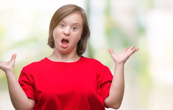 Mladé Dospělé Ženy Downovým Syndromem Zbraněmi Zvedl Otevřené Oči Křičel — Stock fotografie