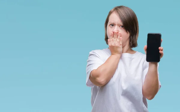 Junge Erwachsene Frau Mit Downsyndrom Zeigt Smartphone Bildschirm — Stockfoto