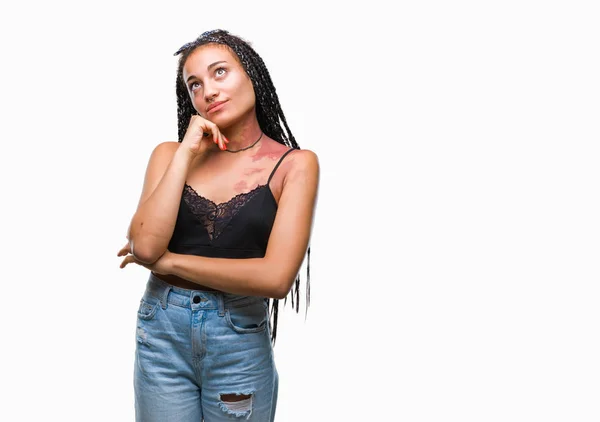 Cabelo Trançado Jovem Afro Americano Com Pigmentação Marca Nascimento Mancha — Fotografia de Stock