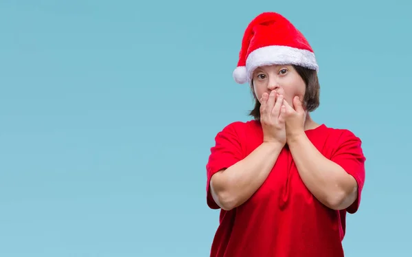 有唐氏综合症的年轻成年妇女戴着圣诞帽在与世隔绝的背景下震惊地捂住嘴巴 误了手 秘密概念 — 图库照片