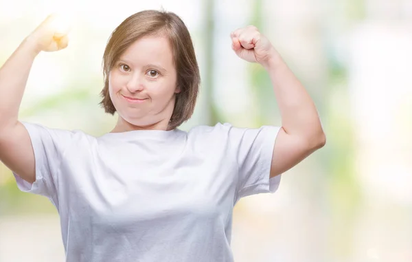 Mulher Adulta Jovem Com Síndrome Sobre Fundo Isolado Mostrando Músculos — Fotografia de Stock