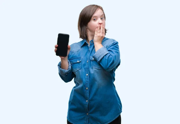 Ung Vuxen Kvinna Med Downs Syndrom Visar Smartphone Skärmen Över — Stockfoto