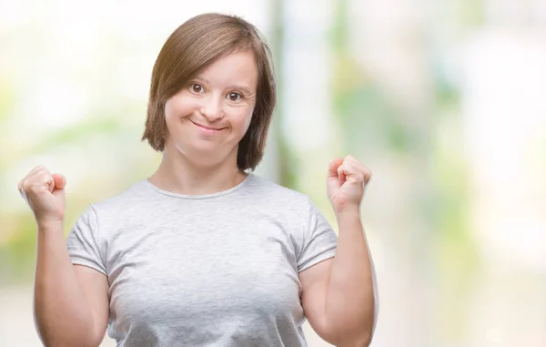 Mujer Adulta Joven Con Síndrome Sobre Fondo Aislado Que Celebra —  Fotos de Stock