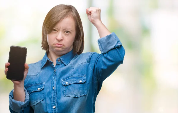 Ung Vuxen Kvinna Med Downs Syndrom Visar Smartphone Skärmen Över — Stockfoto