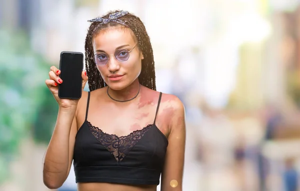 Cabello Trenzado Joven Afroamericano Con Marca Nacimiento Que Muestra Pantalla — Foto de Stock