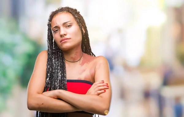 Young braided hair african american with pigmentation blemish birth mark over isolated background skeptic and nervous, disapproving expression on face with crossed arms. Negative person.