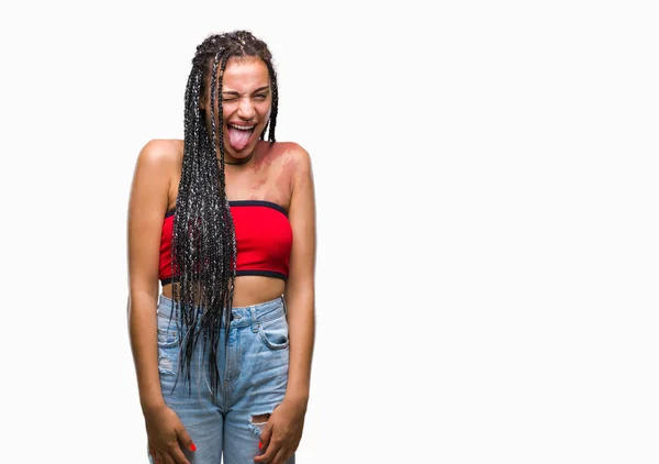 Cabelo Trançado Jovem Afro Americano Com Pigmentação Marca Nascimento Mancha — Fotografia de Stock