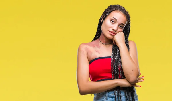 Cabello Trenzado Joven Afroamericano Con Manchas Pigmentación Marca Nacimiento Sobre —  Fotos de Stock