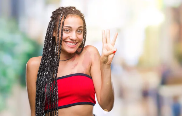 Cabello Trenzado Joven Afroamericano Con Mancha Pigmentación Marca Nacimiento Sobre —  Fotos de Stock