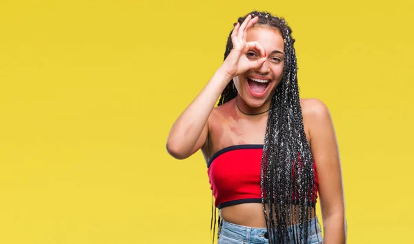 Cabelo Trançado Jovem Afro Americano Com Pigmentação Marca Nascimento Mancha — Fotografia de Stock