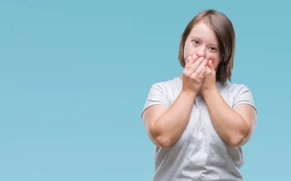 Junge Erwachsene Frau Mit Syndrom Über Isolierten Hintergrund Schockiert Mund — Stockfoto