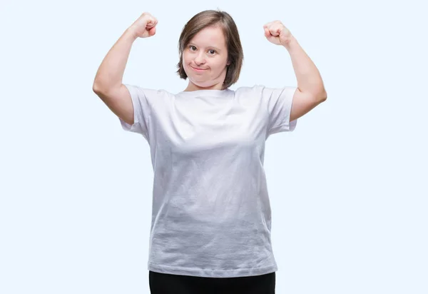 Young Adult Woman Syndrome Isolated Background Showing Arms Muscles Smiling — Stock Photo, Image