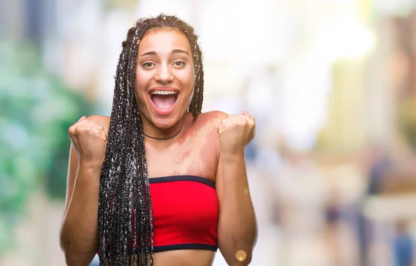 Cabello Trenzado Joven Afroamericano Con Mancha Pigmentación Marca Nacimiento Sobre —  Fotos de Stock