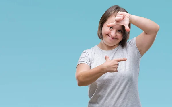 Mulher Adulta Jovem Com Síndrome Sobre Fundo Isolado Sorrindo Fazendo — Fotografia de Stock