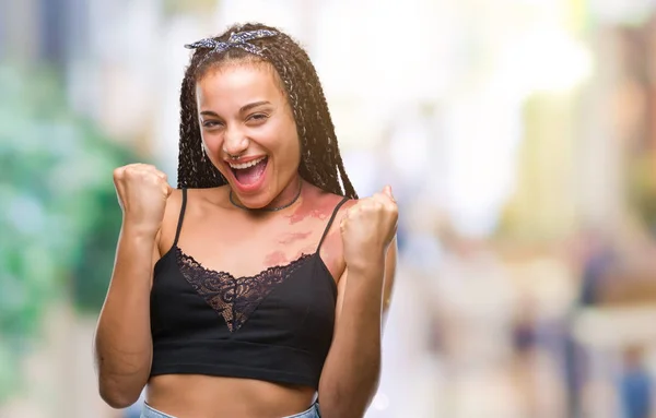 Joven Cabello Trenzado Afroamericano Con Manchas Pigmentación Marca Nacimiento Sobre —  Fotos de Stock