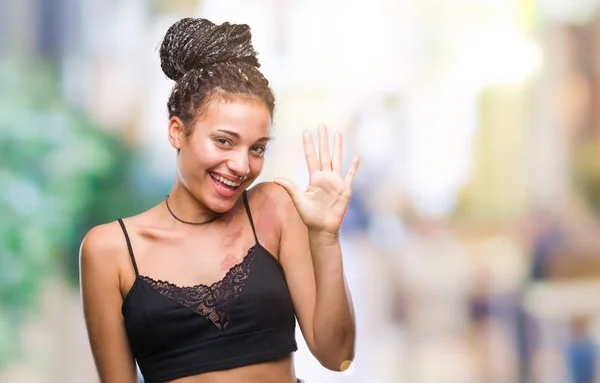 Young braided hair african american with pigmentation blemish birth mark over isolated background showing and pointing up with fingers number five while smiling confident and happy.