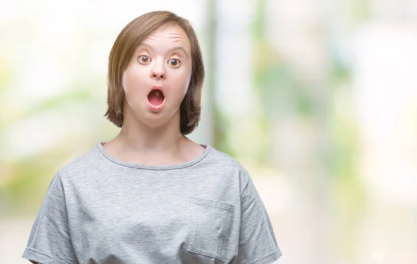 Mladé Dospělé Ženy Downovým Syndromem Izolované Pozadí Strach Šokován Výrazem — Stock fotografie