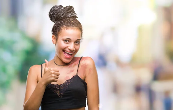 Young braided hair african american with pigmentation blemish birth mark over isolated background doing happy thumbs up gesture with hand. Approving expression looking at the camera with showing success.