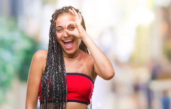 Young braided hair african american with pigmentation blemish birth mark over isolated background doing ok gesture with hand smiling, eye looking through fingers with happy face.