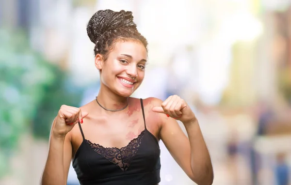Young braided hair african american with pigmentation blemish birth mark over isolated background looking confident with smile on face, pointing oneself with fingers proud and happy.