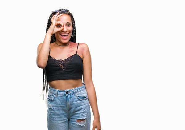 Cabelo Trançado Jovem Afro Americano Com Pigmentação Marca Nascimento Mancha — Fotografia de Stock