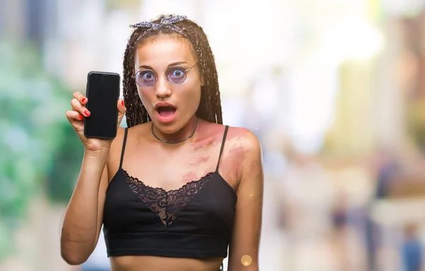 Junge Geflochtene Haare Afrikanisch Amerikanisch Mit Muttermal Zeigt Smartphone Bildschirm — Stockfoto