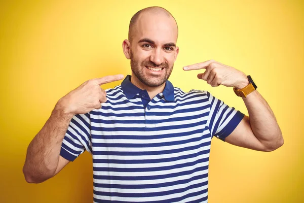 Jovem Careca Com Barba Vestindo Casual Listrado Azul Shirt Sobre — Fotografia de Stock