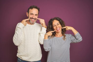 Güzel orta yaş çift izole mor arka plan üzerinde kış kazak giyen neşeli gösteren gülümseyerek ve parmakları diş ve ağız ile işaret. Diş sağlığı kavramı.