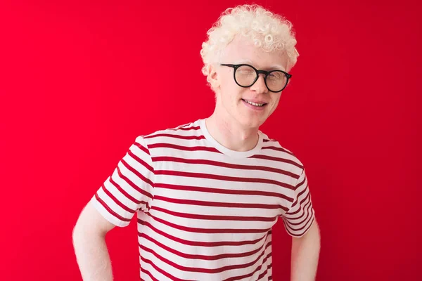 Unga Albino Blond Man Klädd Randig Shirt Och Glasögon Över — Stockfoto