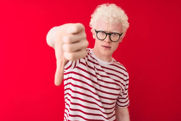 Jeune Homme Blond Albinos Portant Shirt Rayé Lunettes Sur Fond — Photo