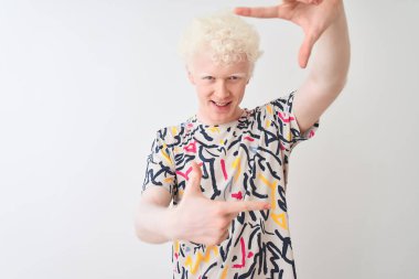 Renkli tişört giyen genç, albino bir adam izole edilmiş beyaz arka plan üzerinde duruyor gülümsüyor ve elleri ve parmakları mutlu yüzlü bir çerçeve yapıyor. Yaratıcılık ve fotoğrafçılık kavramı.