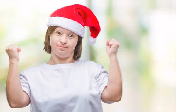 Mulher Adulta Jovem Com Síndrome Usando Chapéu Natal Sobre Fundo — Fotografia de Stock