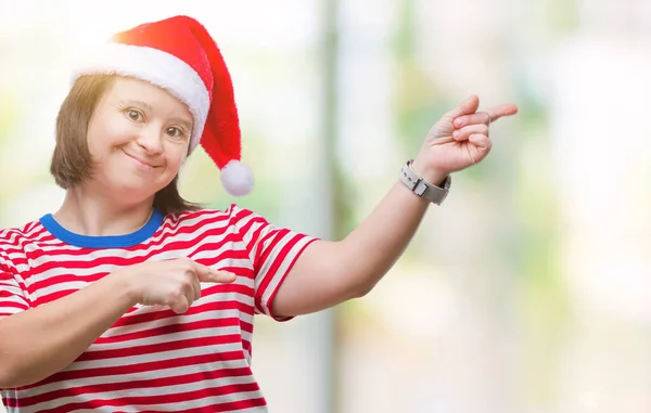 Ung Vuxen Kvinna Med Downs Syndrom Bär Jul Hatt Över — Stockfoto