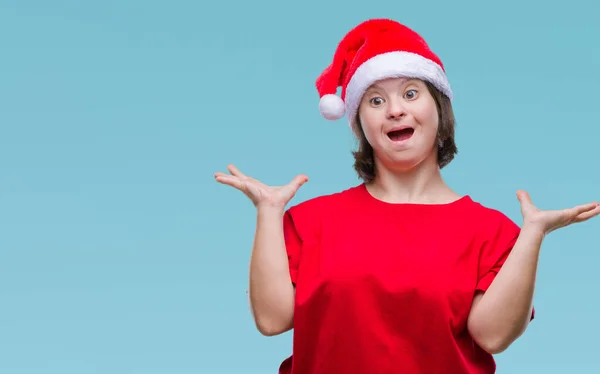 Молодая Взрослая Женщина Синдромом Дауна Рождественской Шляпе Изолированном Фоне Празднует — стоковое фото