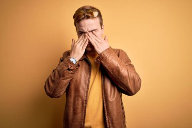 Genç, yakışıklı, deri ceket giyen, izole edilmiş sarı arka planda, yorgun, uykulu ve yorgun bir ifade takınan kızıl saçlı bir adam. Görüş sorunu