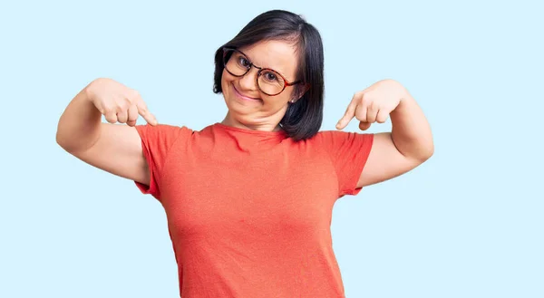 Mujer Morena Con Síndrome Vistiendo Ropa Casual Gafas Que Ven —  Fotos de Stock